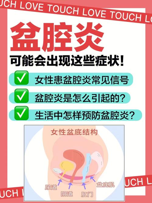 盆腔炎6015可能会出现这些症状6015女性患盆腔炎常见信号60