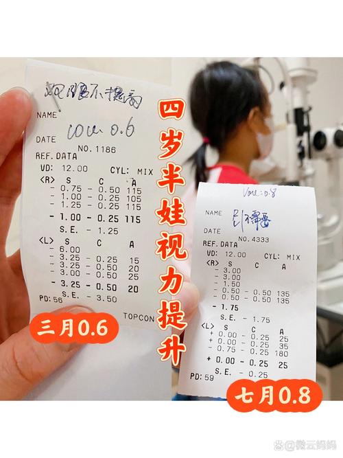 4岁4个月视力0.6提升到0.8