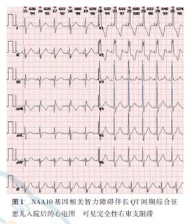 naa10基因相关智力障碍伴长qt间期综合征1例