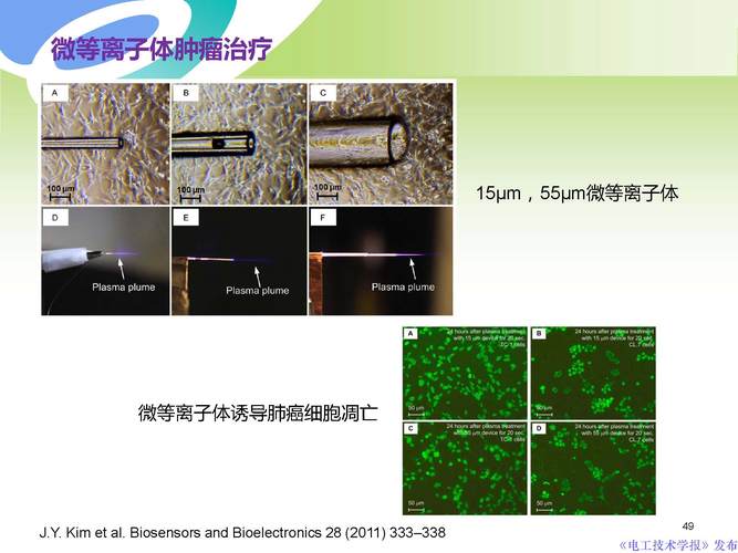 西安交通大学许德晖副教授:等离子体技术治疗癌症的最新研究进展